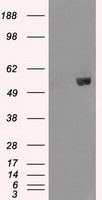 AKT2 Antibody in Western Blot (WB)