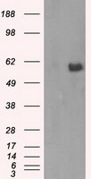 AKT2 Antibody in Western Blot (WB)