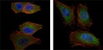 AKT2 Antibody in Immunocytochemistry (ICC/IF)