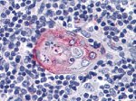 AKT2 Antibody in Immunohistochemistry (Paraffin) (IHC (P))