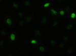 AKT3 Antibody in Immunocytochemistry (ICC/IF)