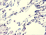 AKT3 Antibody in Immunohistochemistry (Paraffin) (IHC (P))