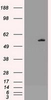 AKT3 Antibody in Western Blot (WB)