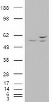 AKT3 Antibody in Western Blot (WB)