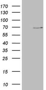 ALAS2 Antibody in Western Blot (WB)