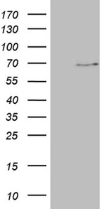 ALAS2 Antibody in Western Blot (WB)