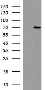 ALB Antibody in Western Blot (WB)