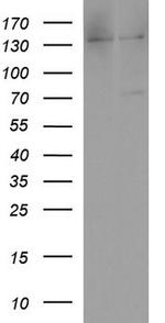 ALB Antibody in Western Blot (WB)