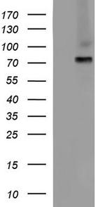 ALB Antibody in Western Blot (WB)