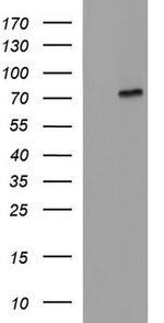 ALB Antibody in Western Blot (WB)