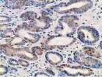 ALDH1A3 Antibody in Immunohistochemistry (Paraffin) (IHC (P))