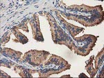 ALDH1A3 Antibody in Immunohistochemistry (Paraffin) (IHC (P))