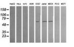 ALDH1A3 Antibody in Western Blot (WB)