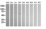 ALDH1A3 Antibody in Western Blot (WB)