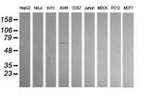 ALDH1A3 Antibody in Western Blot (WB)