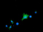 ALDH1L1 Antibody in Immunocytochemistry (ICC/IF)