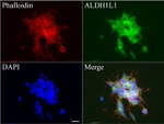 ALDH1L1 Antibody in Immunocytochemistry (ICC/IF)