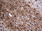 ALDH1L1 Antibody in Immunohistochemistry (Paraffin) (IHC (P))