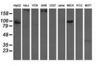 ALDH1L1 Antibody in Western Blot (WB)