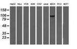 ALDH1L1 Antibody in Western Blot (WB)