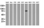 ALDH1L1 Antibody in Western Blot (WB)