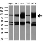 ALDH1L1 Antibody in Western Blot (WB)