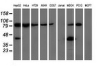 ALDH1L1 Antibody in Western Blot (WB)