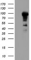 ALDH1L1 Antibody in Western Blot (WB)