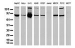 ALDH1L1 Antibody in Western Blot (WB)