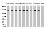 ALDH1L1 Antibody in Western Blot (WB)