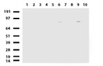 ALDH1L1 Antibody in Western Blot (WB)