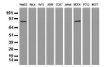 ALDH1L1 Antibody in Western Blot (WB)