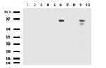 ALDH1L1 Antibody in Western Blot (WB)