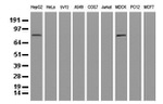 ALDH1L1 Antibody in Western Blot (WB)