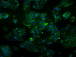 ALDH2 Antibody in Immunocytochemistry (ICC/IF)