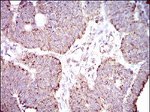 ALDH2 Antibody in Immunohistochemistry (Paraffin) (IHC (P))