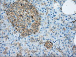 ALDH3A1 Antibody in Immunohistochemistry (Paraffin) (IHC (P))