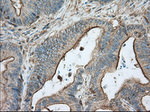 ALDH3A1 Antibody in Immunohistochemistry (Paraffin) (IHC (P))