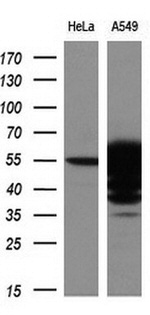 ALDH3A1 Antibody in Western Blot (WB)