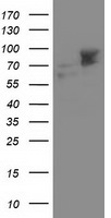 ALDH3A2 Antibody in Western Blot (WB)