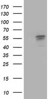 ALDH3A2 Antibody in Western Blot (WB)