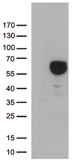 ALDH4A1 Antibody in Western Blot (WB)