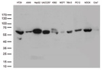 ALDH4A1 Antibody in Western Blot (WB)