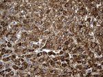 ALDH7A1 Antibody in Immunohistochemistry (Paraffin) (IHC (P))