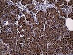 ALDH7A1 Antibody in Immunohistochemistry (Paraffin) (IHC (P))