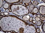 ALDH7A1 Antibody in Immunohistochemistry (Paraffin) (IHC (P))