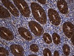 ALDH7A1 Antibody in Immunohistochemistry (Paraffin) (IHC (P))