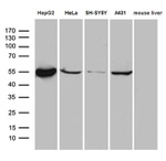 ALDH7A1 Antibody in Western Blot (WB)