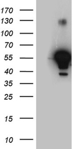 ALDH7A1 Antibody in Western Blot (WB)