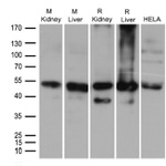 ALDH9A1 Antibody in Western Blot (WB)